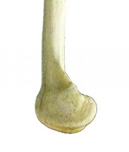 ARTICOLAZIONE FEMORO TIBIALE 003 osce spine center