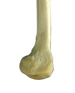 ARTICOLAZIONE FEMORO TIBIALE 004 osce spine center