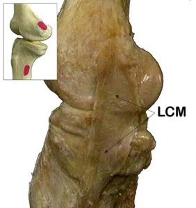ARTICOLAZIONE FEMORO TIBIALE 017 osce spine center