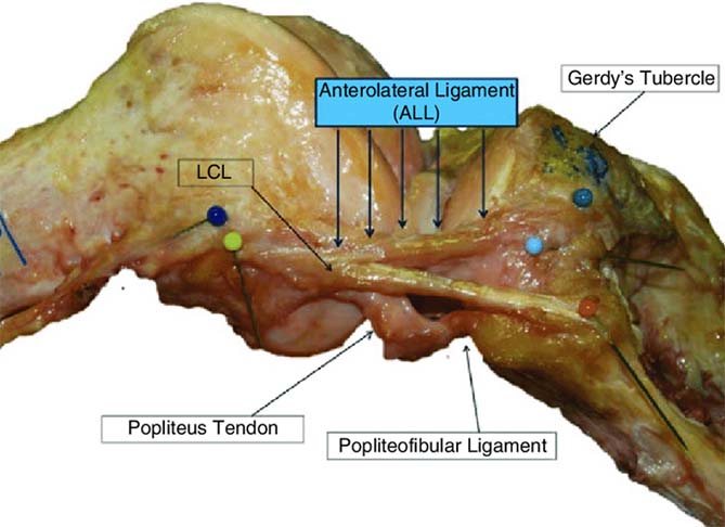 ARTICOLAZIONE FEMORO TIBIALE 021 osce spine center