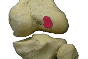 ARTICOLAZIONE FEMORO TIBIALE 025 osce spine center