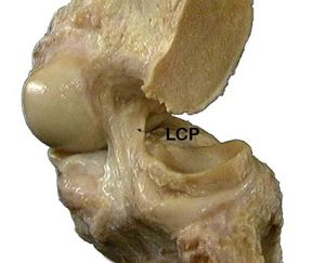 ARTICOLAZIONE FEMORO TIBIALE 026 osce spine center
