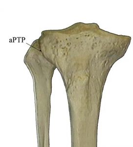 ARTICOLAZIONE PERONEO TIBIALE 001 osce spine center
