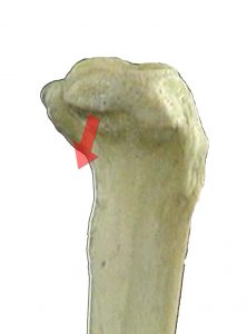 ARTICOLAZIONE PERONEO TIBIALE 003 osce spine center
