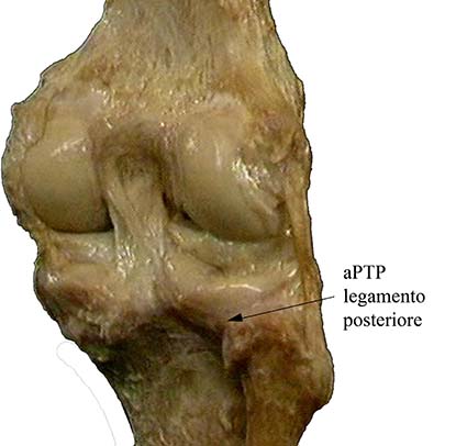 ARTICOLAZIONE PERONEO TIBIALE 005 osce spine center