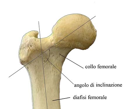 ARTICOLAZIONE ANCA 003 osce spine center