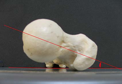 ARTICOLAZIONE ANCA 004 osce spine center