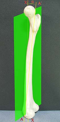 ARTICOLAZIONE ANCA 005 osce spine center