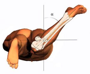 ARTICOLAZIONE ANCA 006 osce spine center