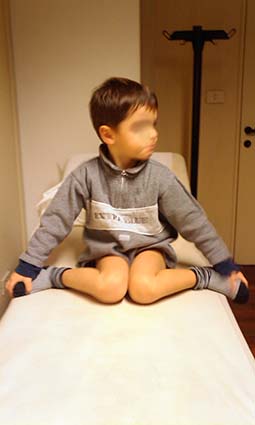 ARTICOLAZIONE ANCA 009 osce spine center