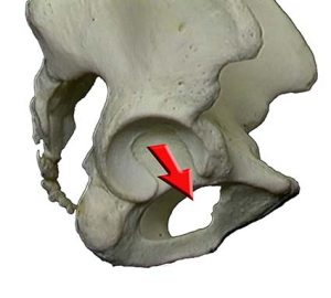 ARTICOLAZIONE ANCA 014 osce spine center
