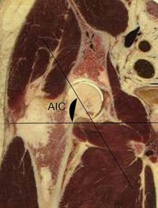 ARTICOLAZIONE ANCA 015 osce spine center