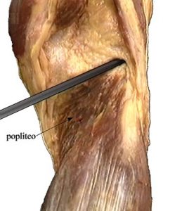 MUSCOLI GINOCCHIO 030 osce spine center