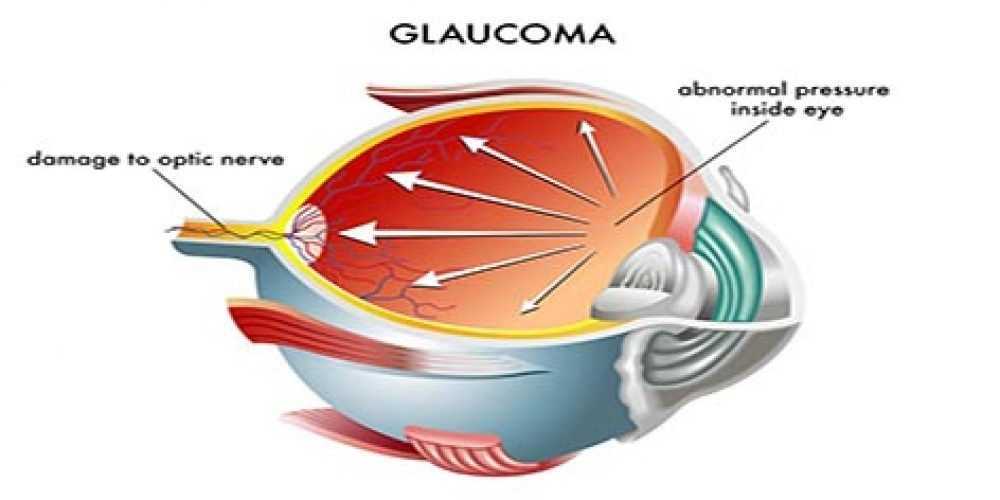 Osteopatia e Glaucoma: un trattamento sconosciuto